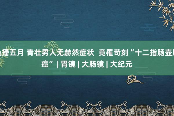 色播五月 青壮男人无赫然症状  竟罹苛刻“十二指肠壶腹癌” | 胃镜 | 大肠镜 | 大纪元